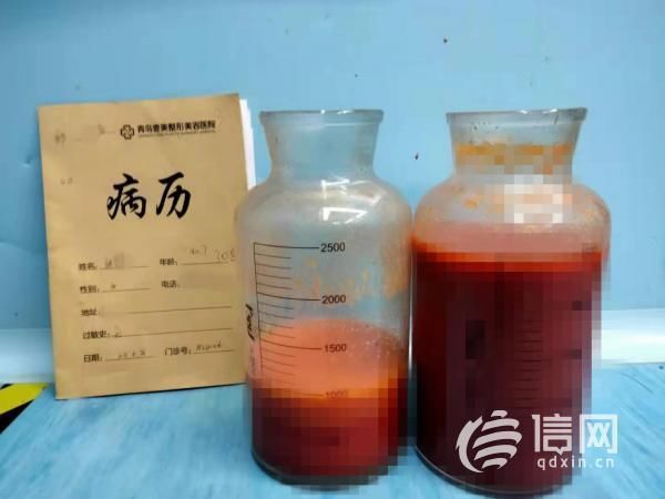 女士|做完面部填充没啥效果 青岛壹美天成整形暂未回应