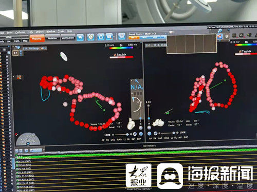 心内科|《山东医专第一附属医院·“心”起点》①：不负古稀老人信任，心内科成功为七旬老人解除房颤危机