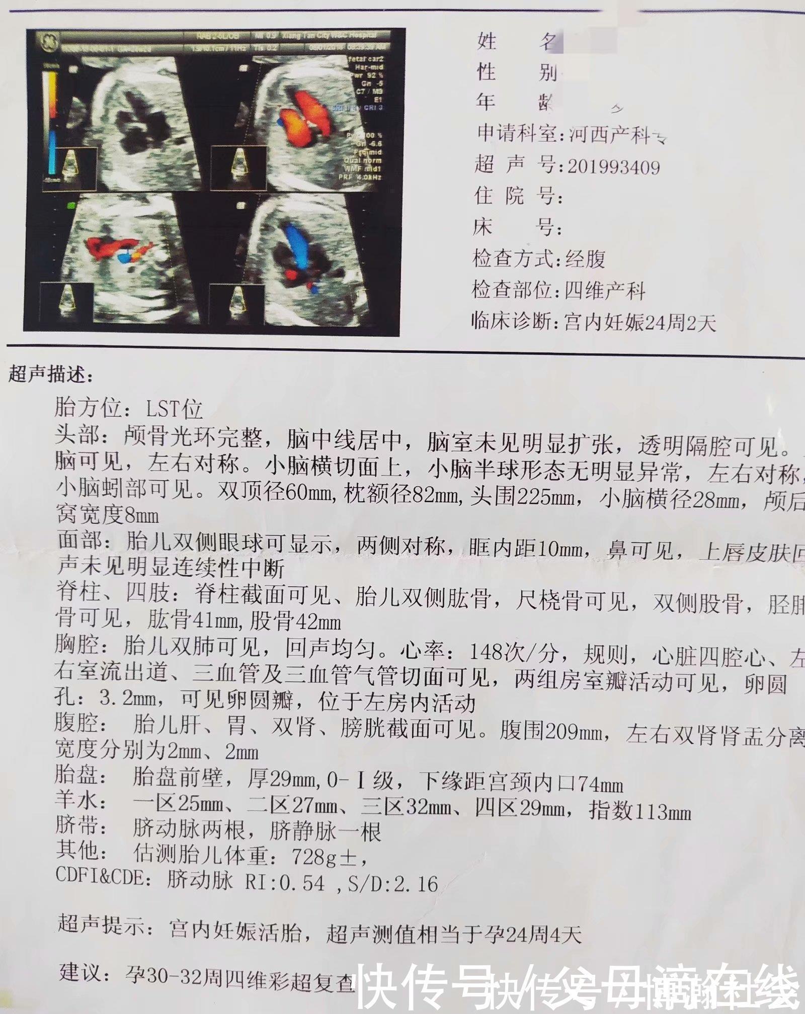 妈妈们|孕期大排畸检查,快速通过及注意事项,你想知道的都在这里