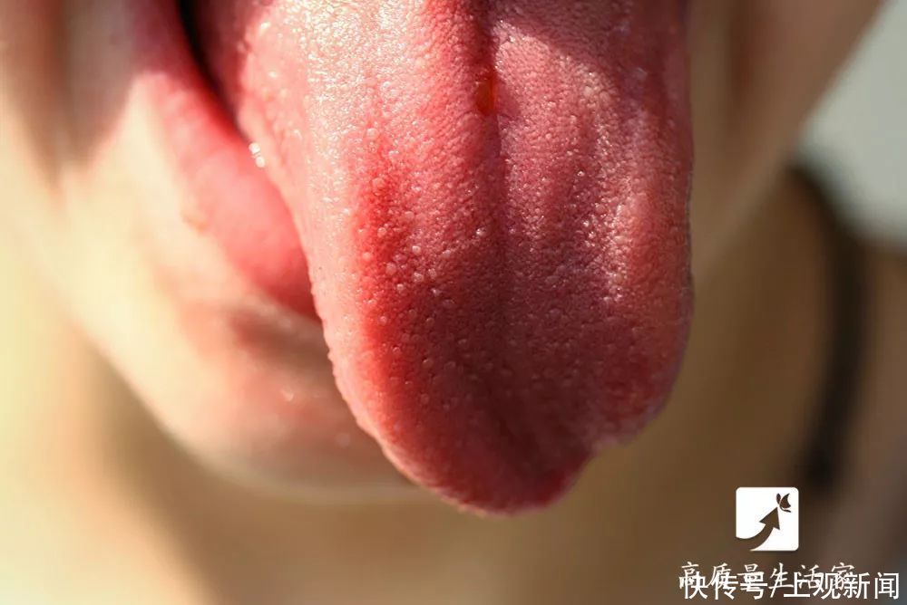  越来越|脑梗越来越多？多半都是“拖”出来的，有这4种情况要注意了