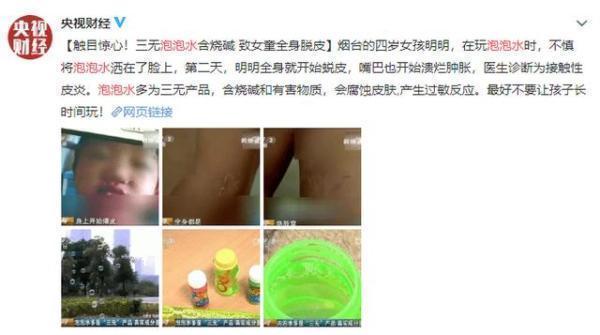 玩具区|4岁女孩玩“七彩泡泡机”,竟把自己玩毁容!家长痛哭就不该买