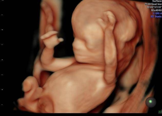 为什么有些医院做四维彩超不让家属陪同这些原因，大家有权知道