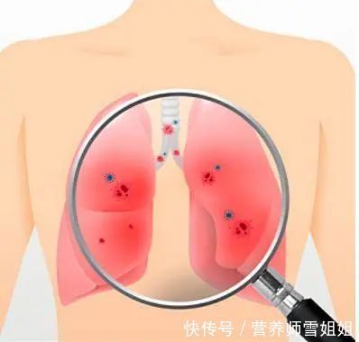疾病|46-55岁,是疾病爆发期,少做三事,护好四处,助力健康度过