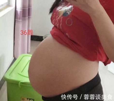 差异|好丑?产检单上的胎儿,和实际胎儿有哪些差异?