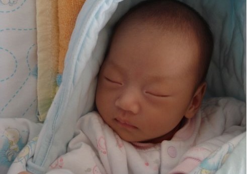 皱褶|两个月大的婴儿身体发臭,医生查出结果,婆婆怒斥儿媳无知