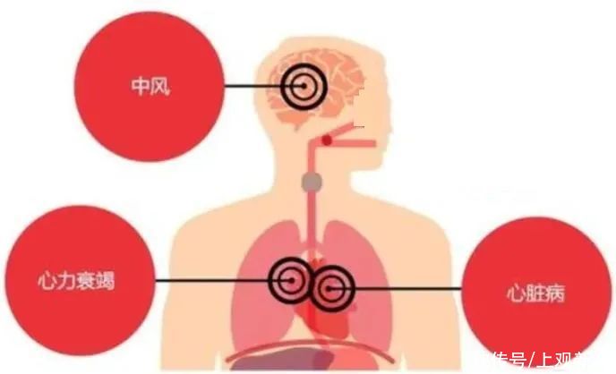 高峰|早晚高峰堵车可怕，堵血管更可怕