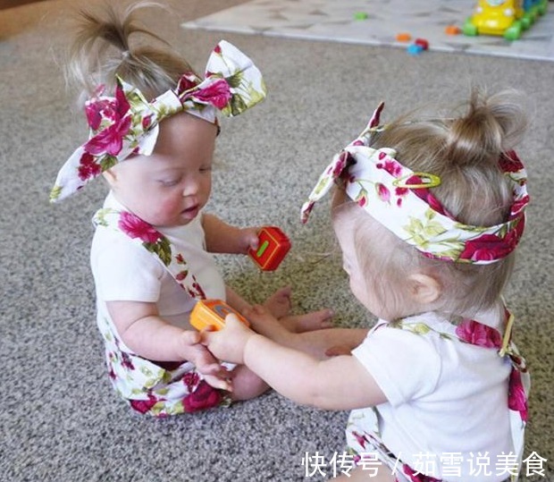 唐氏双胞胎|妈妈生下唐氏双胞胎姐妹,并不轻言放弃,唐宝都有一张相同的脸