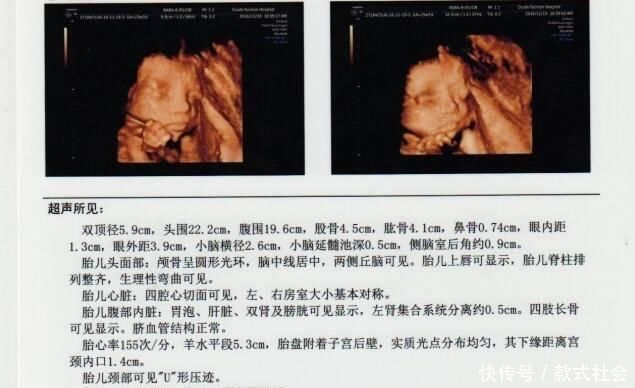 四维彩超|孕期四维彩超，能看懂检查报告的这三点，胎儿或许就没有小秘密了