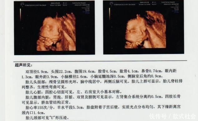 四维彩超|孕期四维彩超,能看懂检查报告的这三点,胎儿或许就没有小秘密了