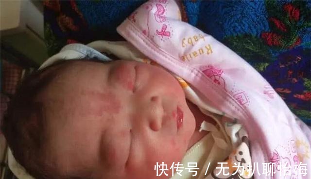 举动|孩子的“胎记”哪来的?作为母亲要知道,孕妈的这些举动是元凶