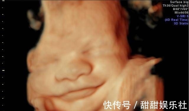 性别|为什么有些医院做四维彩超不让家属陪同这些原因,大家有权知道