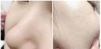 茶树精油 一定要告诉你这5款护肤品测评!给你选出最适合自己的那一款!