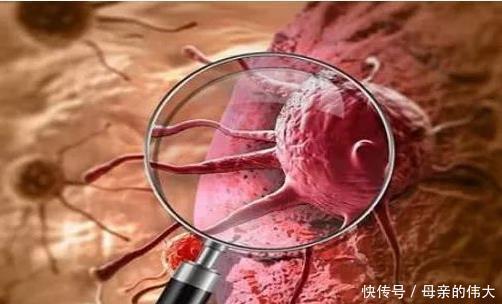 男女|肿瘤医生不论男女，当皮肤有这“反常”，癌症已大肆张扬