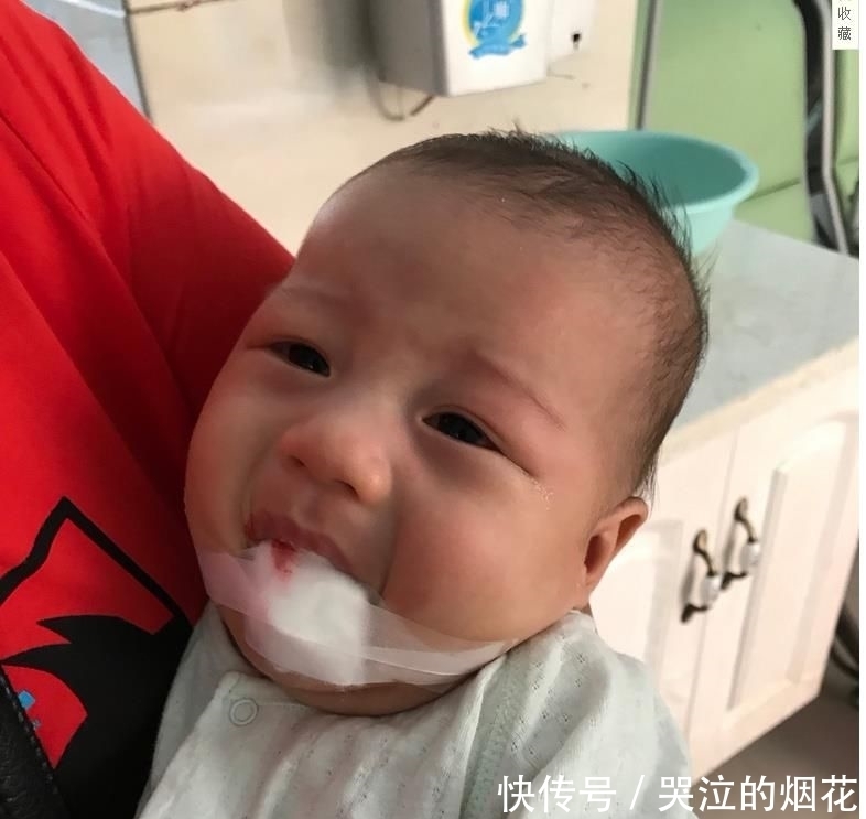 剪刀|思量再三还是带宝宝去剪舌系带,医生那一剪刀看得我心好疼