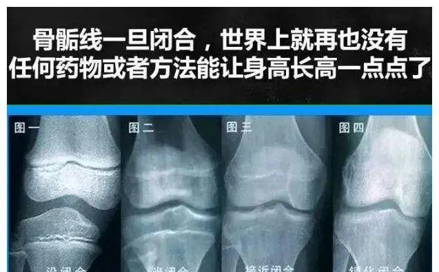 发育期|孩子13岁,吃了它,身高永远停在了1米4……