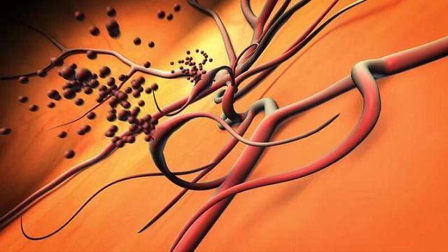 心血管疾病|糖尿病人用小米替代大米，会得到哪些惊喜看下答案不吃亏