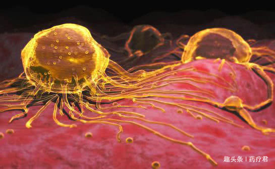 息肉|癌症来之前，多会经历＂癌前病变＂，这些实用建议，每一条都重要