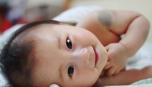 胎记|胎记是怎么来的产科医生孕期远离3种行为，避免胎儿长记号