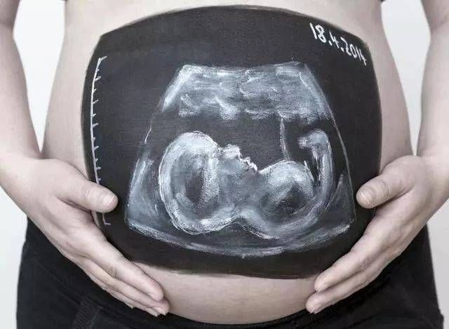 孕妇做B超有辐射对胎宝宝健康影响大？你对＂B超＂知多少