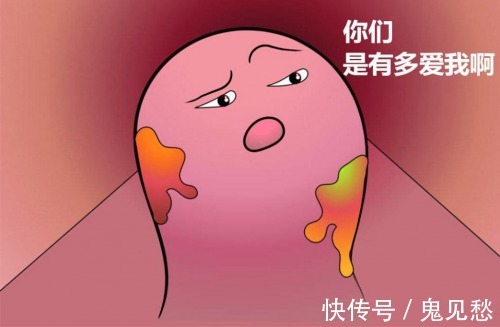 痔疮膏|痔疮肉球脱出推不回去怎么办？如何正确缓解痔疮肉球？