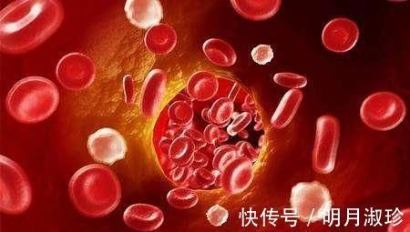 口渴|糖尿病人如何改善喝水多、尿多的情况?教你每天喝多少水最合适