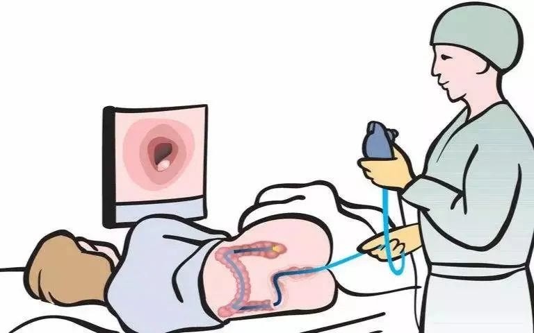 结直肠癌|34岁抗癌博主阿健离世,结直肠癌发病人数逐年攀升!要怎么防?