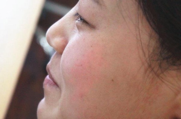 潮热|44到55岁是更年期高发年龄,如果你出现以下4中情况,就是更年期