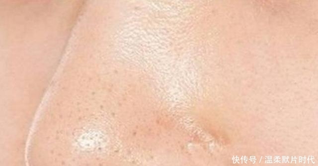 白色|你知道鼻子上挤出的“白色物体”到底是什么吗?