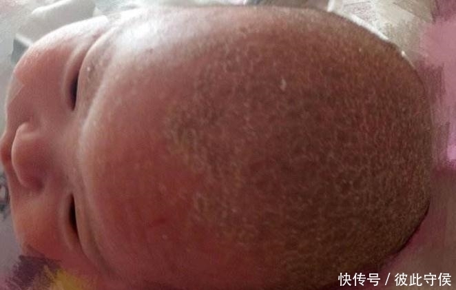 情况|大脑发育健康的婴儿大部分情况下在婴儿期会有这四种反应，说明智商非常高