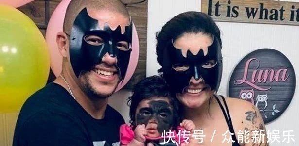 外科医生|真人版“蝙蝠侠”，美国一婴儿患罕见黑色素痣，形状酷似蝴蝶翅膀