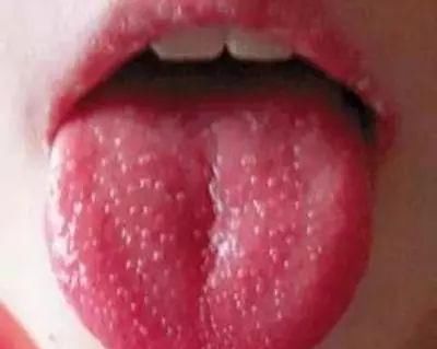  果你|免疫力是长寿关键，到底该如何加强自己免疫力？你的舌头知道答案