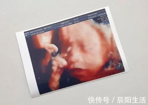 顺产|到底能不能顺产?看最后一次B超,这3个数据已经揭露答案