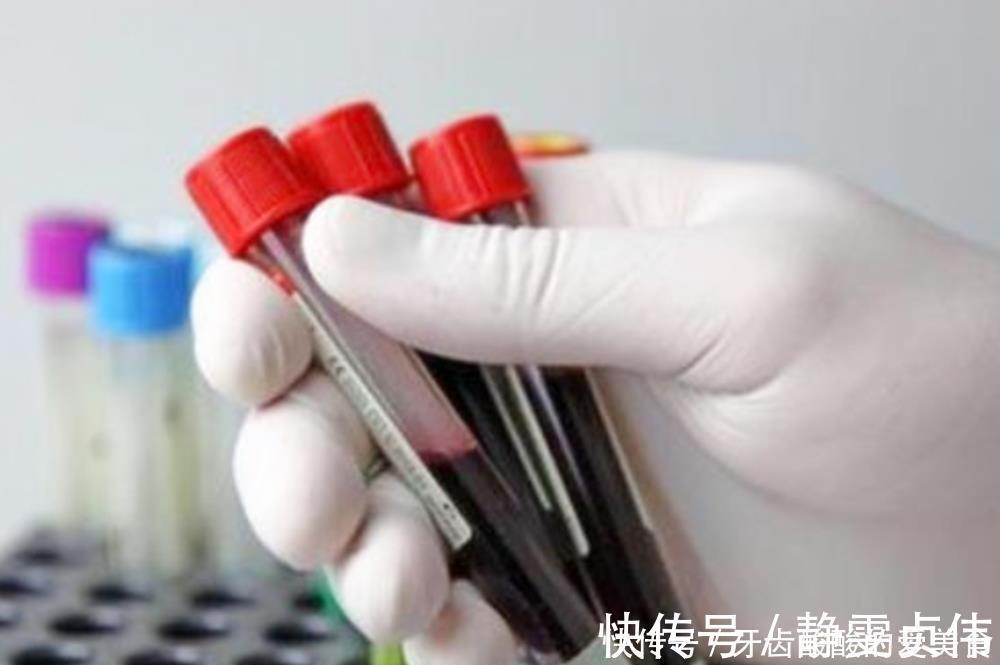 血管|一个孕期下来,孕妇要抽多少管“血”?过来人:血管都“干瘪”了