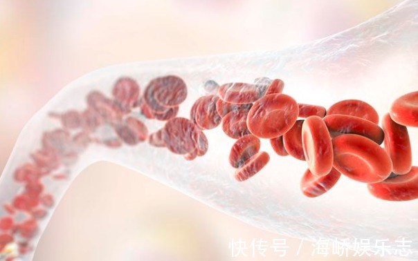 黄色瘤|身体出现4种表现,建议赶紧去查血脂,早发现早治疗