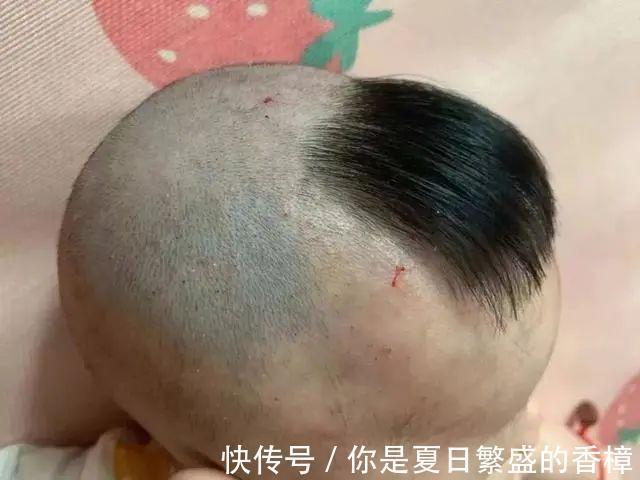 孩子|婆婆在宝宝身上动“手脚”，妈妈掀开衣服后大哭，网友迷信害人