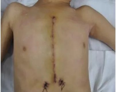 妙手|山东省立三院心脏大血管外科 为折翼的天使妙手“补心”