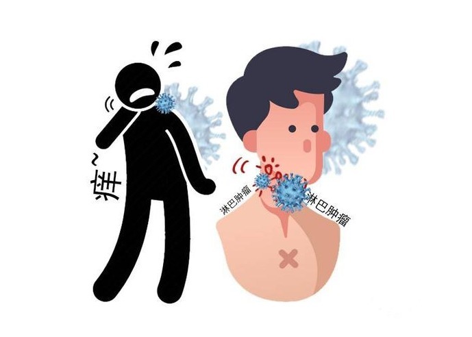 症状|癌症靠近，不是悄无声息！身体4个异常，其实是在暗示你，别错过