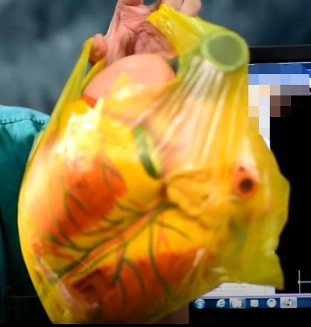 轮椅|16岁初中生突然不能活动,医生从他体内抽出红色液体