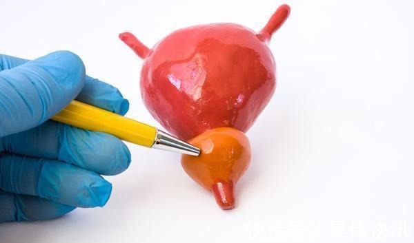 尿路梗阻|膀胱出现这4个症状，可能是膀胱癌的前兆，早发现早治疗