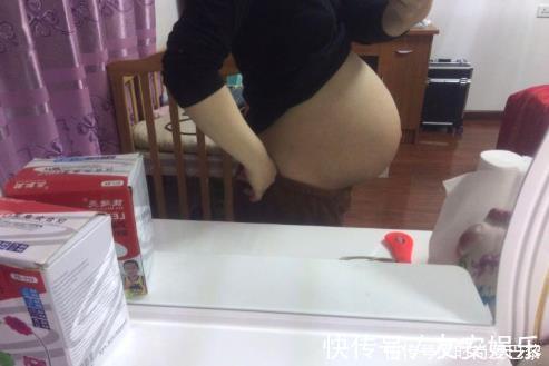 孕产|四维彩超通过后,胎儿为何会畸形建议提前了解