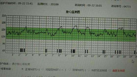 宝妈|十月怀胎要做多少次产检每次查些啥注意啥准备啥最全指南