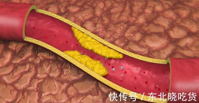 血管健康|睡前坚持吃一粒维生素e,一段时间后,这三个好处显而易见