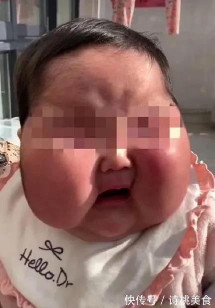 大头娃|中国各地出现大头娃,是什么原因造成的,应该如何惩治?