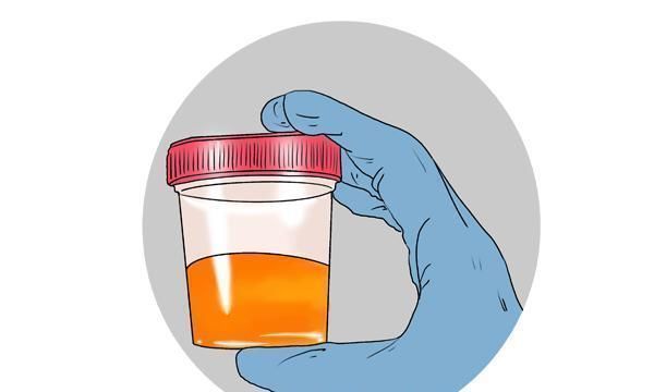 肝功能|上厕所时，若出现4个症状，或和肝癌有关，医生需留心观察