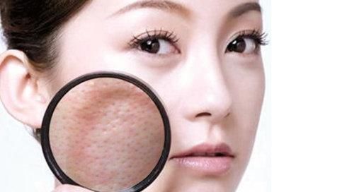 现在小姑娘的钱真的很好骗吗？这三款网红爽肤水，难用真不值