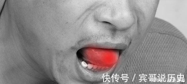 腐败性|脾脏出现问题，身体可能会发出5个信号！常按一个穴位，养脾健胃！