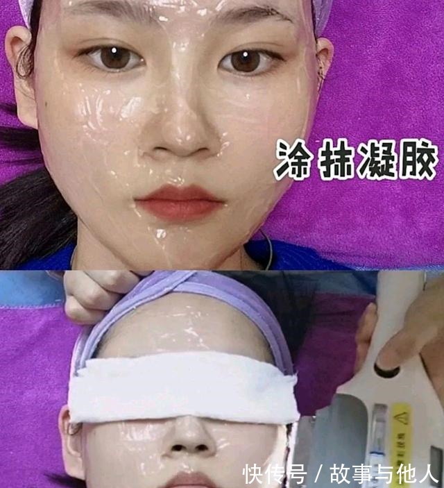 医美小白 光子嫩肤为什么受人追捧!