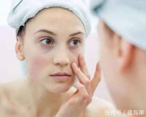 去痘印|5种人最喜欢招痘印喜欢,若你是其中之一,那么需要特别小心