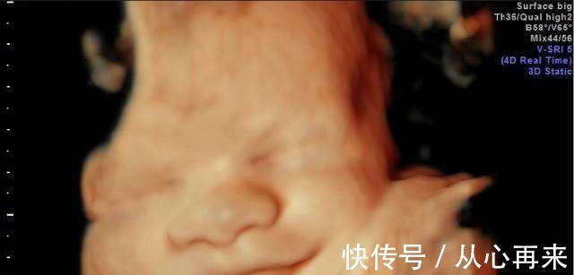 小茹|为什么有些医院做四维彩超不让家属陪同这些原因,大家有权知道