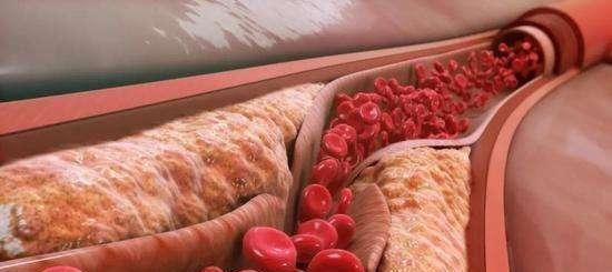 吃红薯也有禁忌,这个时间段尽量不要吃,看看你吃对了吗?